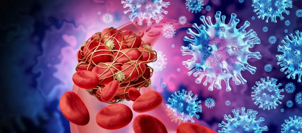 Piastrine del sangue avvolte dalla proteina fibrinogeno e dal virus COVID-19 spike